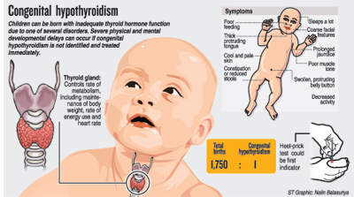Preventing Congenital Hypothyroidism by Newborn Screening