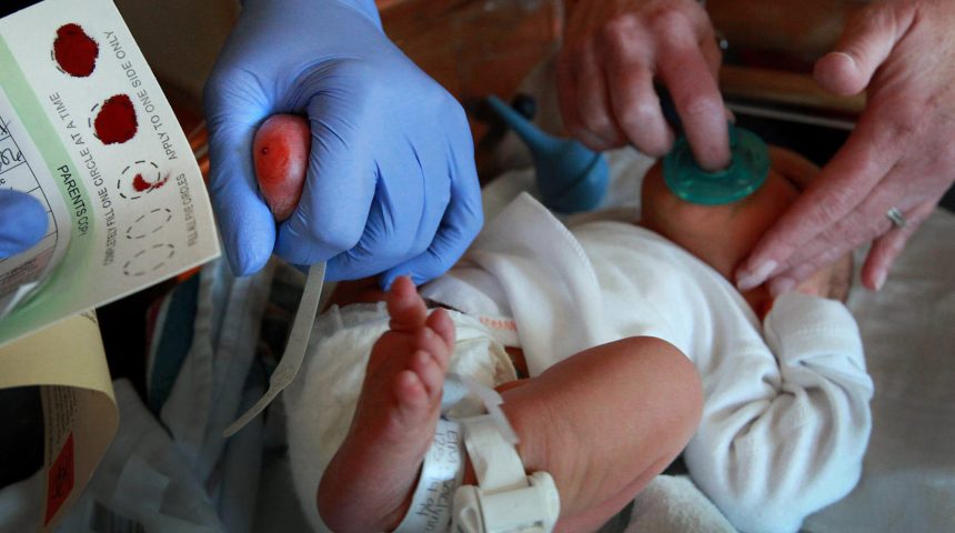 Amino Acids (AA) Disorders in Newborns